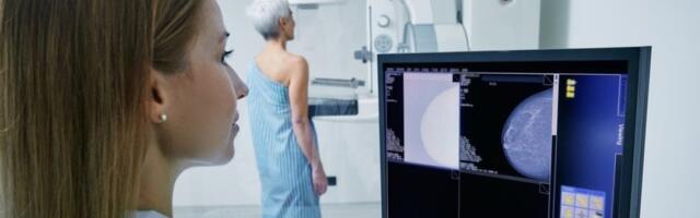 Kada je vreme za prvu mamografiju? Doktori otkrivaju gde mnoge žene greše