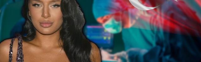 SESTRA LUNE ĐOGANI SKINULA ZAVOJE! Isplivala slika Nine nakon operacije u Turskoj! (FOTO)