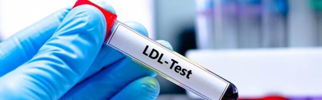 Tihi ubica u krvi: Kardiolozi tvrde da 1 promena čisti organizam od lošeg holesterola