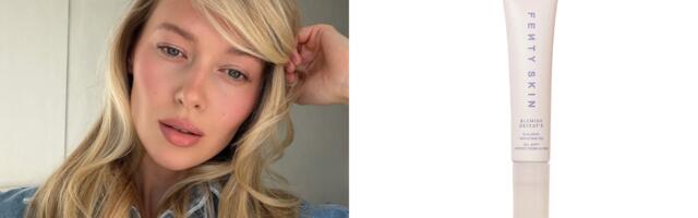 Tečni flasteri za akne su pravi game-changer kada je šminkanje problematične kože u pitanju