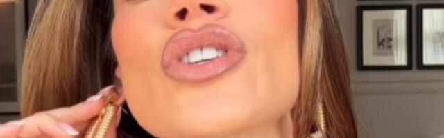 KAKVI SU JOJ OVO PODLIVI? Ognjenova bivša htela da pokaže MINIĆ, umesto njega sevnule MODRICE!