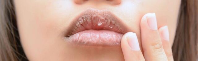 Dala je 460 evra za punije usne i DOŽIVELA PAKAO: Stanje joj se POGORŠALO (VIDEO)