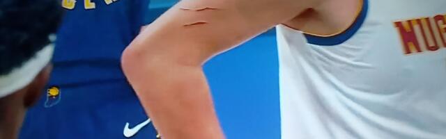 Na šta samo liči Jokićeva ruka! Kao da ga je grebala divlja zver: Molimo vas, isecite nokte /FOTO/