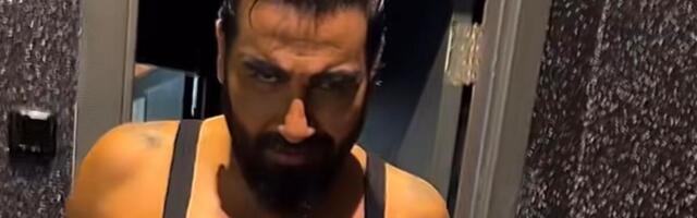 POKAZAO SILIKONE NA CECINOM NASTUPU! Azis šokirao kad je URADIO GRUDI - uporedili smo NEKAD i SAD, REZULTAT JE ŠOK