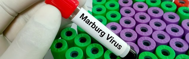 U Gvineji otkriven visokozarazni i vrlo opasni virus Marburg