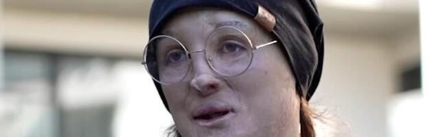Bjeloruska komičarka s invaliditetom nastavlja rad u egzilu