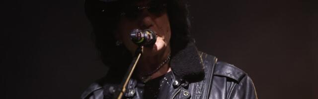 Milić: Prerezali su mi nerve, nekontrolisano boli