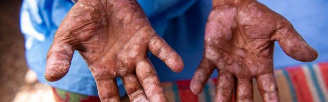 Alarmantno: Balkan na nogama - U ove dve zemlje otkrivena opasna zaraza