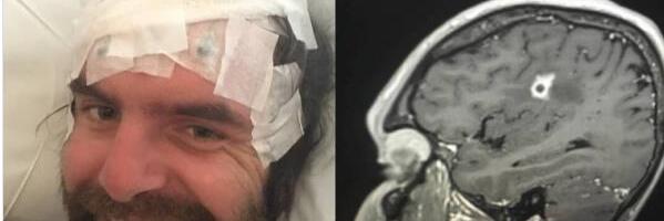 "Preminuli su svi koje poznajem s ovom dijagnozom" Pao je s bicikla, a onda mu je život postao pakao