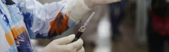 Korona napada srce više nego što smo mislili, upozoravaju lekari