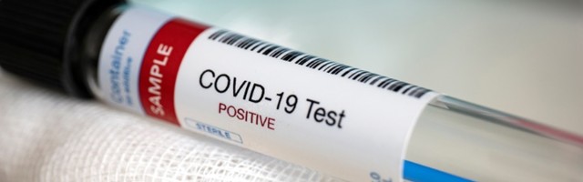 Najgori dan u Hrvatskoj: Još 3.082 obolelih, umrlo 32 osobe