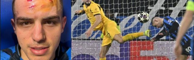 Ovako izgleda Nikola Krstović nakon što je dobio kopačku u glavu: Imaće ozbiljne ožiljke na licu od krampona