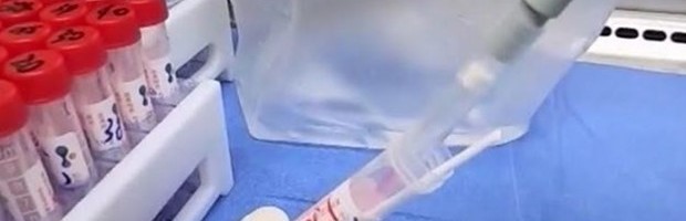 BROJ NOVOOBOLELIH U PADU, ALI NEMA OPUŠTANJA