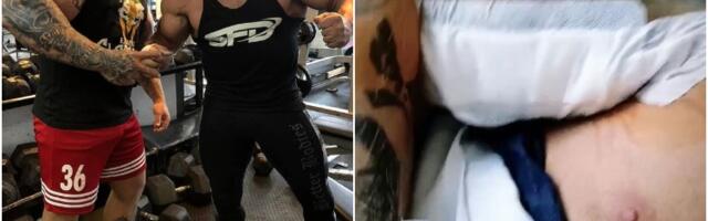 Poljski 'kralj sintola' podvrgnut nizu operacija kako mu lekari spasili ruke