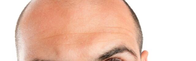 Žene otkrivaju: zašto su ćelavci bolji od čupavaca?