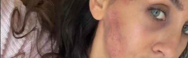CELA U MODRICAMA! Srpska glumica (34) podelila prizor od koga su se SVI NAJEŽILI: Evo šta se dogodilo! (FOTO)