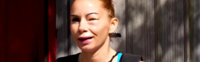 Povređena učesnica EXATLONA izašla iz bolnice: Otkrila sve detalje stanja (VIDEO)