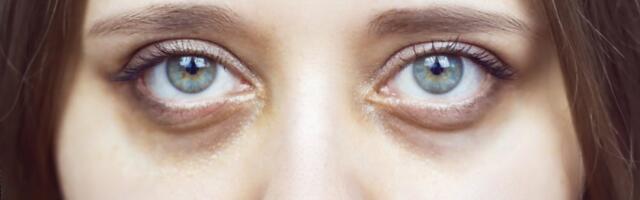 Rešite se podočnjaka: Trik sa hajlajterom pravi čuda - zbogom tamnim kolutovima (VIDEO)