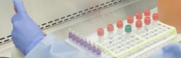 KORONA PRESEK: KRALJEVO 68, SRBIJA 4.103