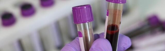 CO2 iz vazduha menja našu krv