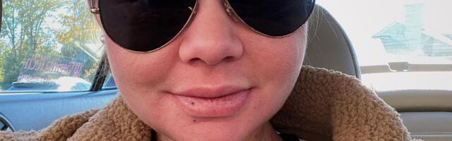 Koža joj gori za 15 sekundi na suncu: Kao vampir beži od svetlosti, a razlog je zastrašujući