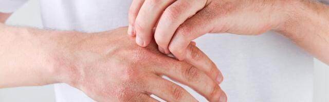 Ruke su vam stalno ispucale? Potopite ih 10 minuta u ova dva sastojka i koža će ponovo biti mekana