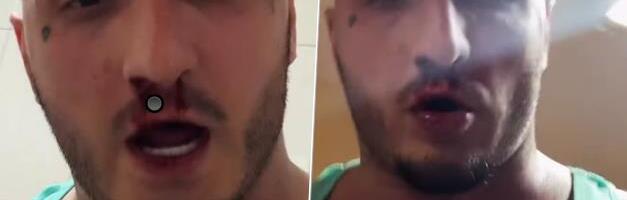 KRV MU CURI IZ NOSA, SPOMENUO I BATINE! Srpski reper usred noći objavio jeziv snimak! (FOTO)