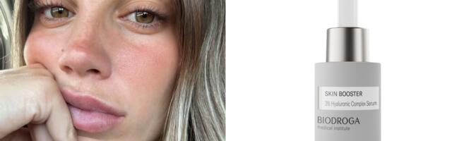 Complex serumi su multitasking skincare trik koji nam je trebao!