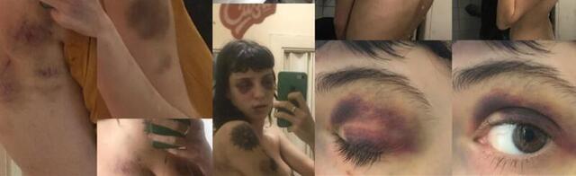 Bez milosti pretukao pa opljačkao bivšu devojku Ruskinju! Policija traga za Stefanom dečkom iz Srbije (FOTO)