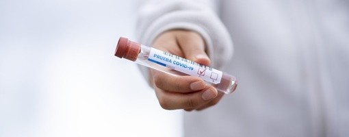 Od ponedeljka u RS testiranje na koronavirus samo po preporuci lekara