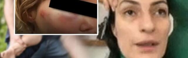 MAJKA MALTRETIRANOG DEČAKA OGOLILA DUŠU! Dve generacije žrtava! "Stariji sin je trpeo nasilje, a malom Vuku sada ponovo viču ćaci“