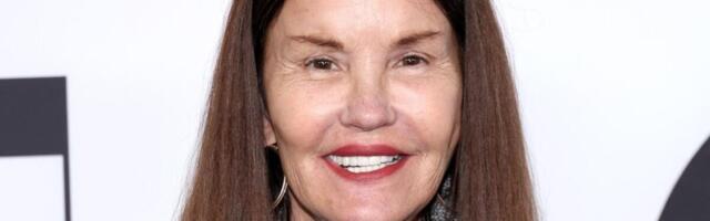 OČI I USTA JEDVA MRDA OD BOTOKSA, PLASTIČAR JOJ IZMENIO LIČNI OPIS! Kad vide slike od ranije ZINU OD ŠOKA