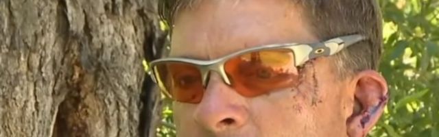 MEDVED MU UŠAO U KUĆU I NAPAO GA U KUHINJI: Pogledali smo se, a onda me je udario i napravio PUKOTINU NA GLAVI! (VIDEO)