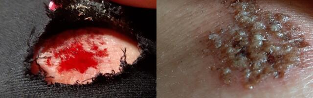 Za povrede na javnom mestu i oštećenja automobila zbog loših ulica Kragujevac godišnje isplaćuje milione - Koliko i za šta sve građani tuže lokalnu samoupravu?