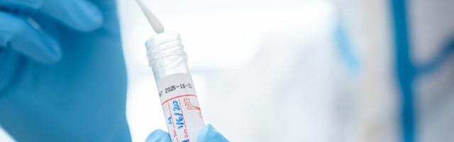 CRNI REKORD Umrla 41 osoba, više od 7.500 novozaraženih