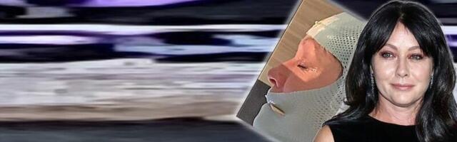 Šenon Doerti gubi bitku sa rakom! Suze liju niz lice dok joj zrače mozak: Pripremila sam haljinu u kojoj želim da me sahrane!