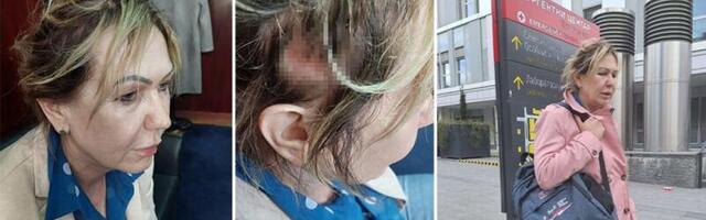 Slavica Vujačić ima simptome potresa mozga! Napadnuta aktivistiknja SNS trpi jake glavobolje, povraća i veoma je potresena!