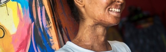 Ne zbog siromaštva, ova devojka pati od retke bolesti i nikad nije okusila hranu! Tužno