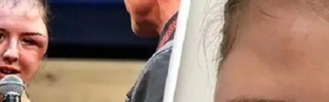 Otkazan bokserski meč nakon što se lice bokserke nadulo usred dramatičnog okršaja