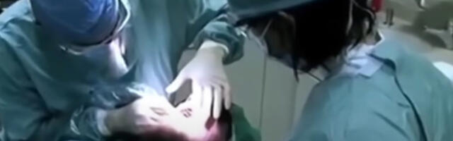 &quot;IZGLEDALA SAM KAO KONJ!&quot; Lažni zubar iz Hrvatske napravio HAOS paru iz Beča, sve im NAPLATIO 16 HILJADA EVRA: &quot;Dobio je 28 anestezija, ZAMALO DA UMRE!&quot;