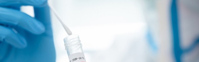 U Hrvatskoj 766 novobolelih, umrlo 80 osoba