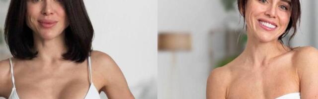 Silikon više nije u modi: Zašto žene širom sveta uklanjaju implantate?