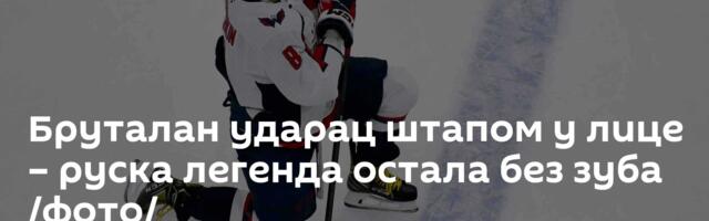 Бруталан ударац штапом у лице – руска легенда остала без зуба /фото/