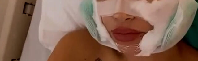 Danas izgleda neprepoznatljivo a na korekcije je "pukla" 15.000 evra: Ovako danas izgleda bivša zadrugarka