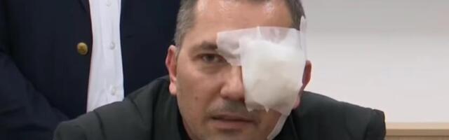 AKTIVISTA SNS BRUTALNO NAPADNUT U ARANĐELOVCU Zadobio tešku povredu oka, opisao scene užasa: "Slomio mi je naočare, staklo mi je ušlo u oko!" (FOTO/VIDEO)