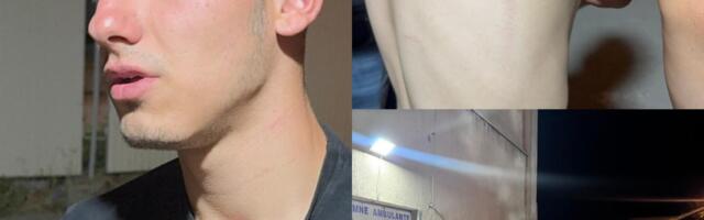 Mladić tvrdi da ga je policija pretukla