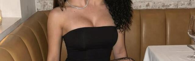 Za njih kažu da su najlepše sijamske bliznakinje: Rade 2 posla za jednu platu, dele momke, ali jedno sve šokira