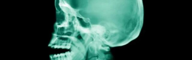 Naučnici identifikovali do sada nepoznati mišić na ljudskom telu