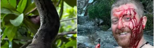 Stidljivi piton ugrizao radoznalog avanturistu za čelo