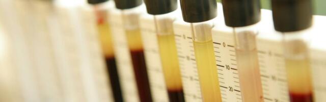 OVA KRVNA GRUPA ŽIVI DUŽE I SPORIJE STARI! Naučnici šokirali odgovorom - "IMUNI SISTEM IM JE MANJE SKLONIJI..."